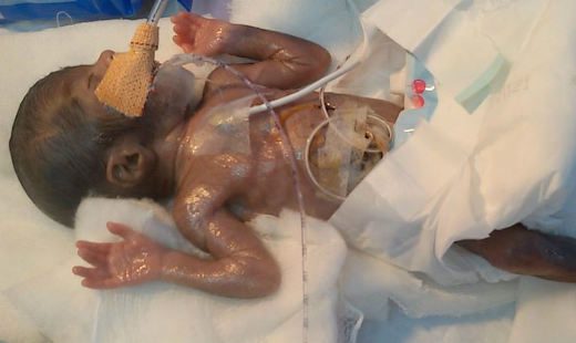 Baby Miracle